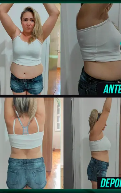 Antes e Depois de usar Secaps Black